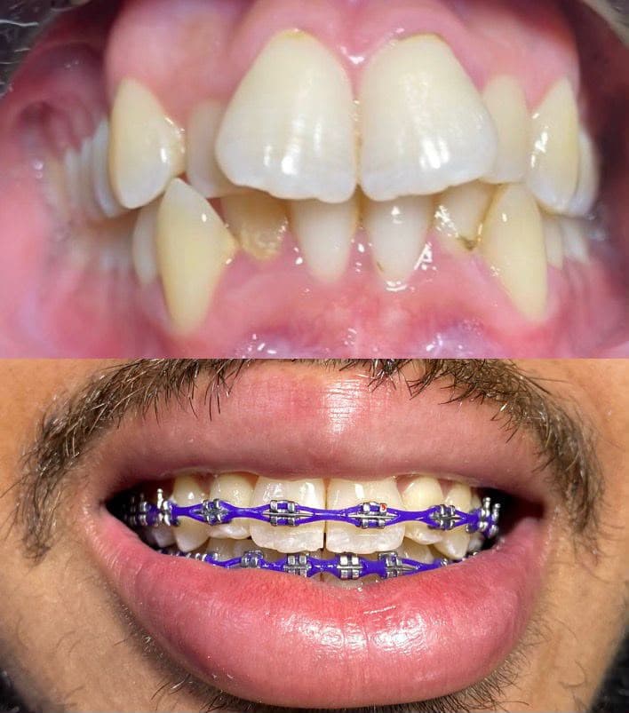 Sonrisas que hemos transformado — 5