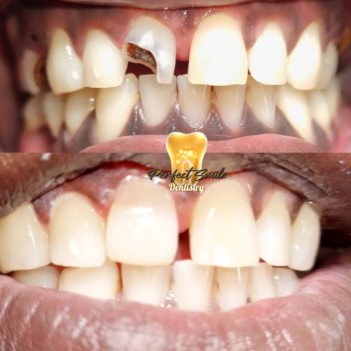 Sonrisas que hemos transformado — 6