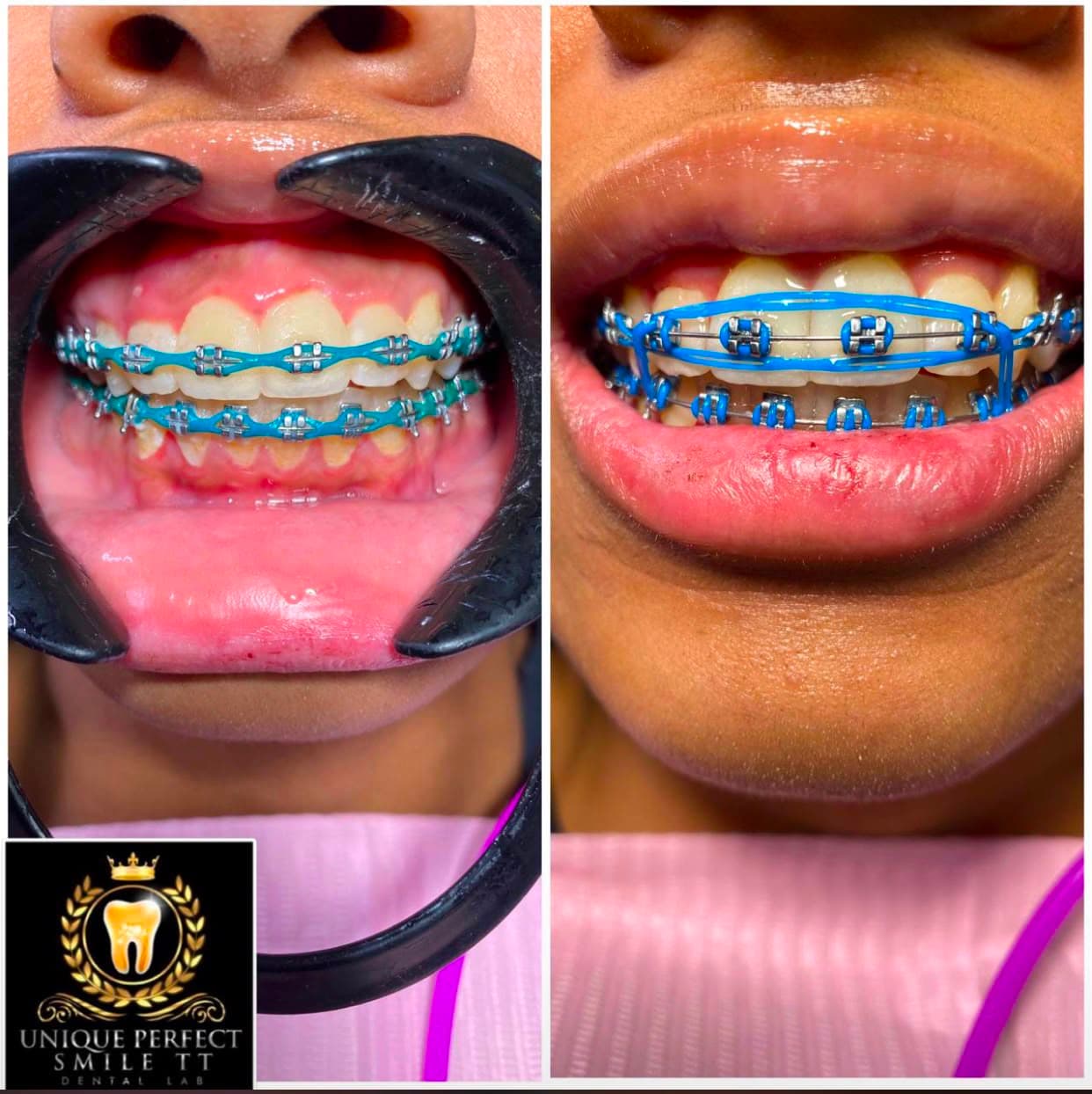 Sonrisas que hemos transformado — 10