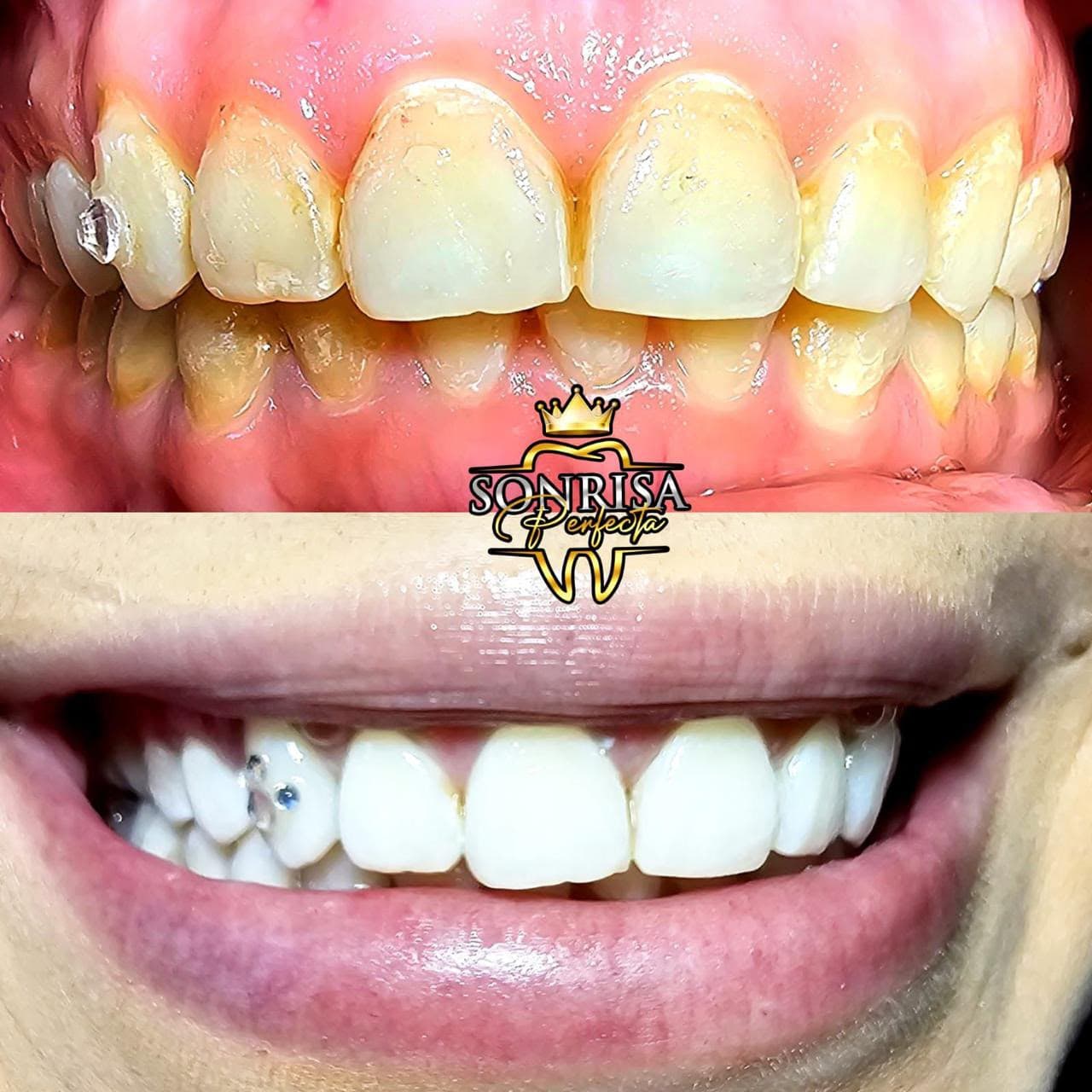 Sonrisas que hemos transformado — 13