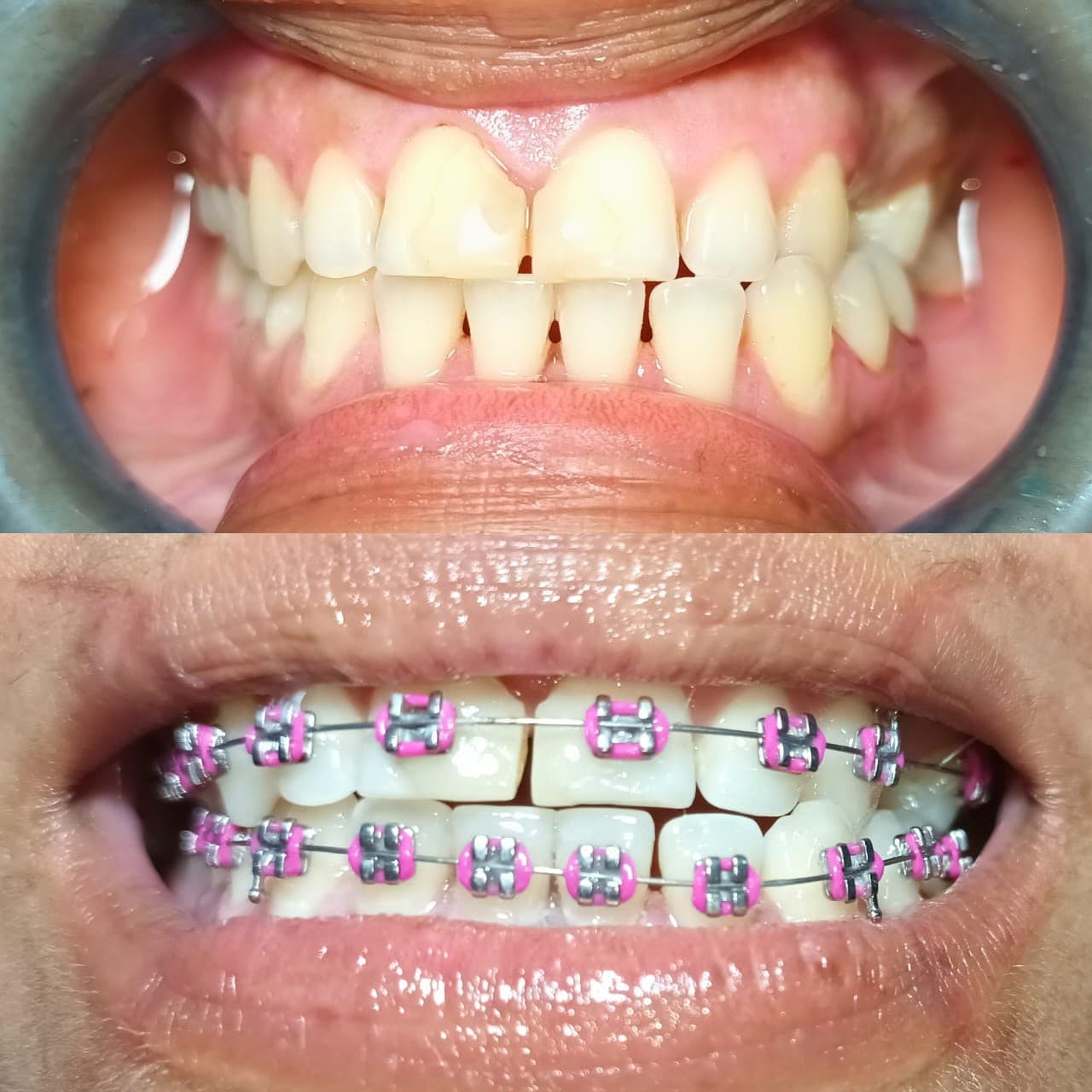 Sonrisas que hemos transformado — 18