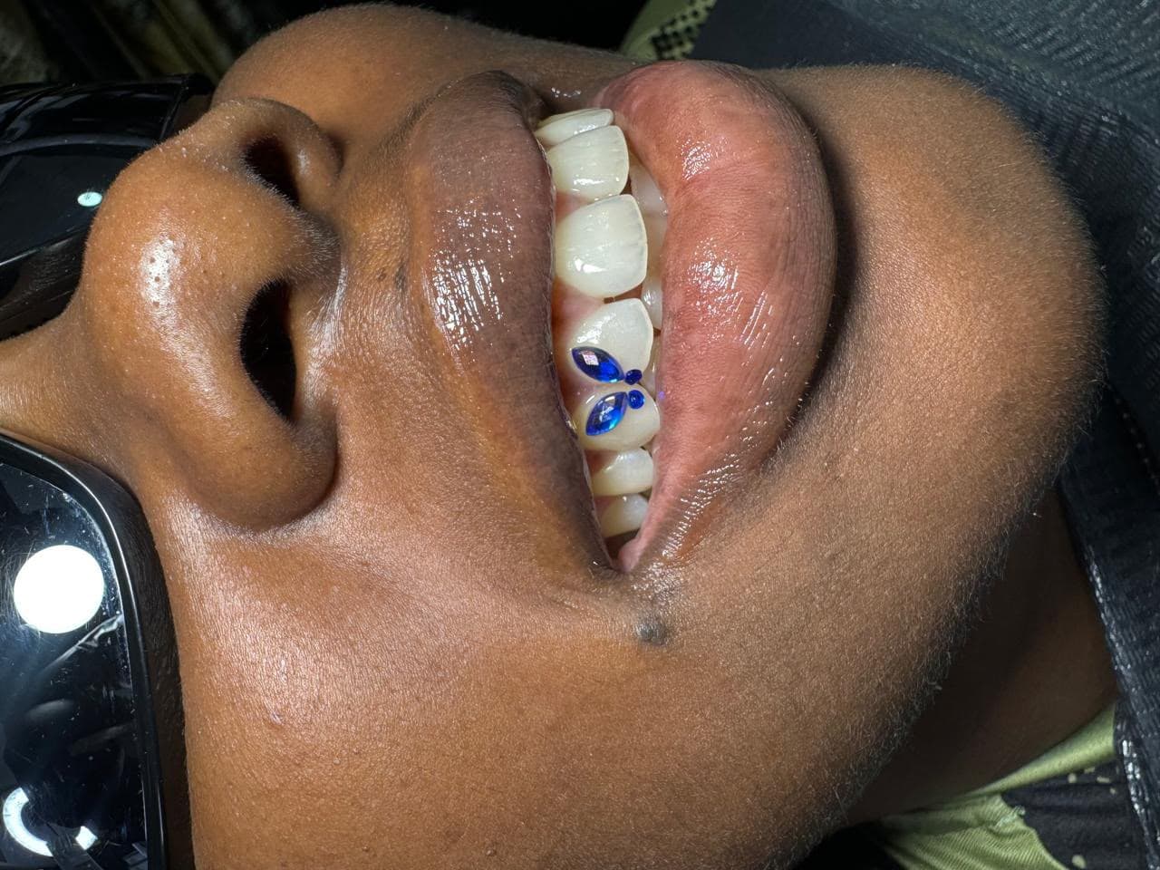 Sonrisas que hemos transformado — 20
