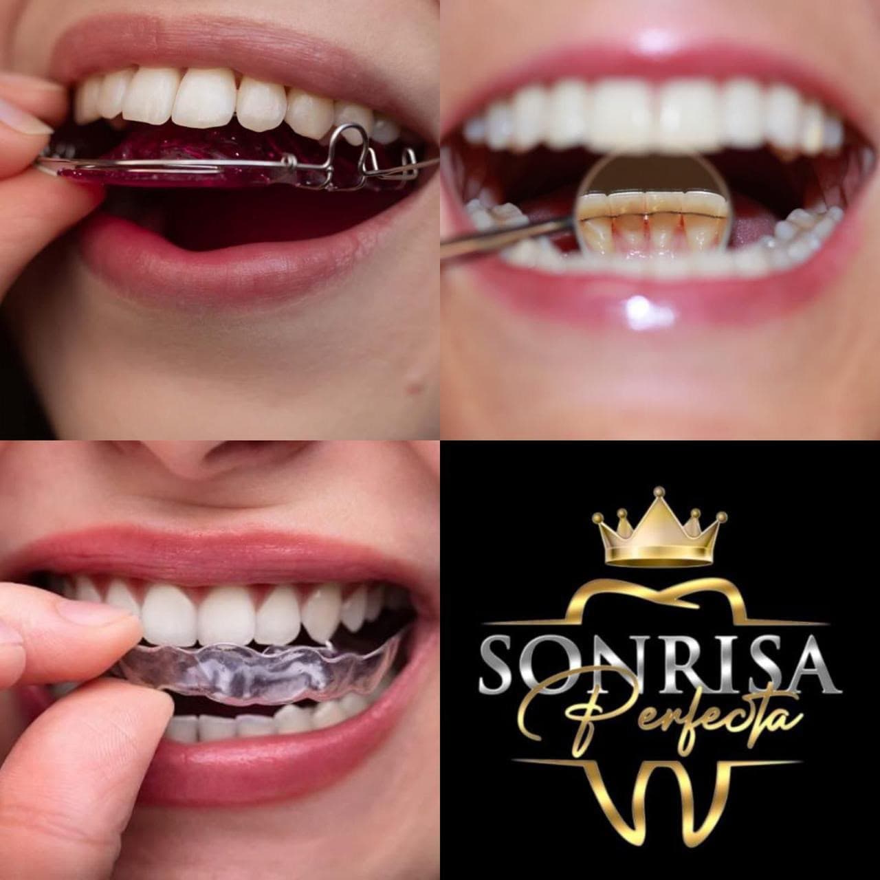 Sonrisas que hemos transformado — 23